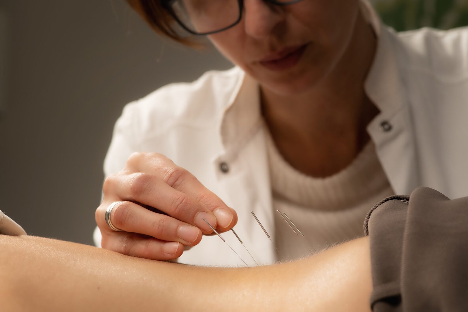 Profesional realizando tratamiento de acupuntura a un paciente, ideal para una web de acupuntura en Mataró